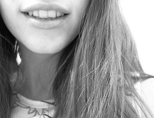 Black and white photo of a female with a chipped tooth