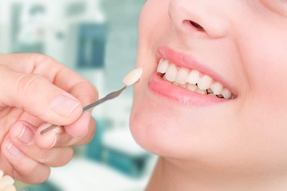 Woman receives the cosmetic dentistry procedure veneers