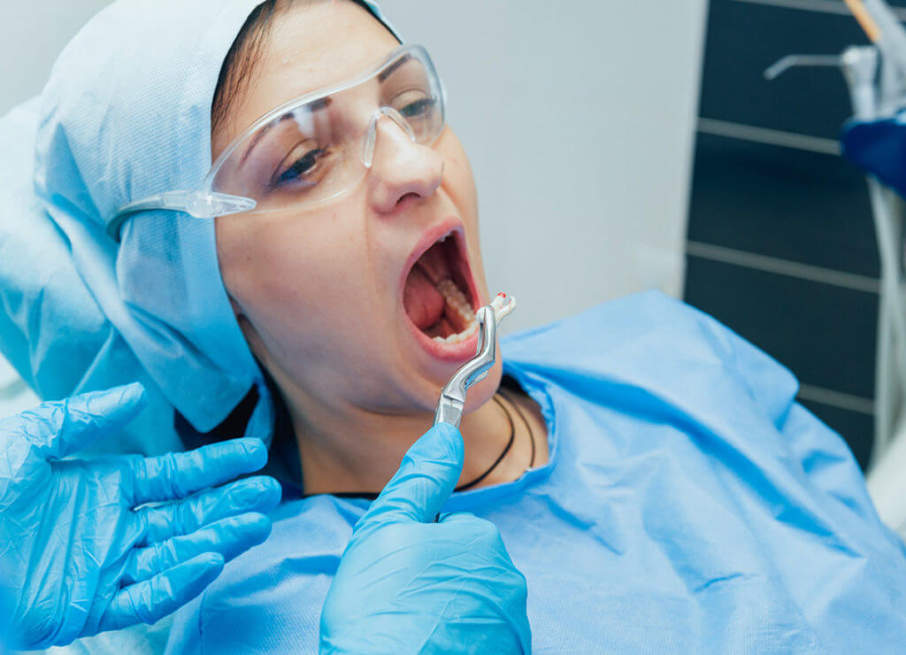 Young woman in a wisdom teeth removal procedure