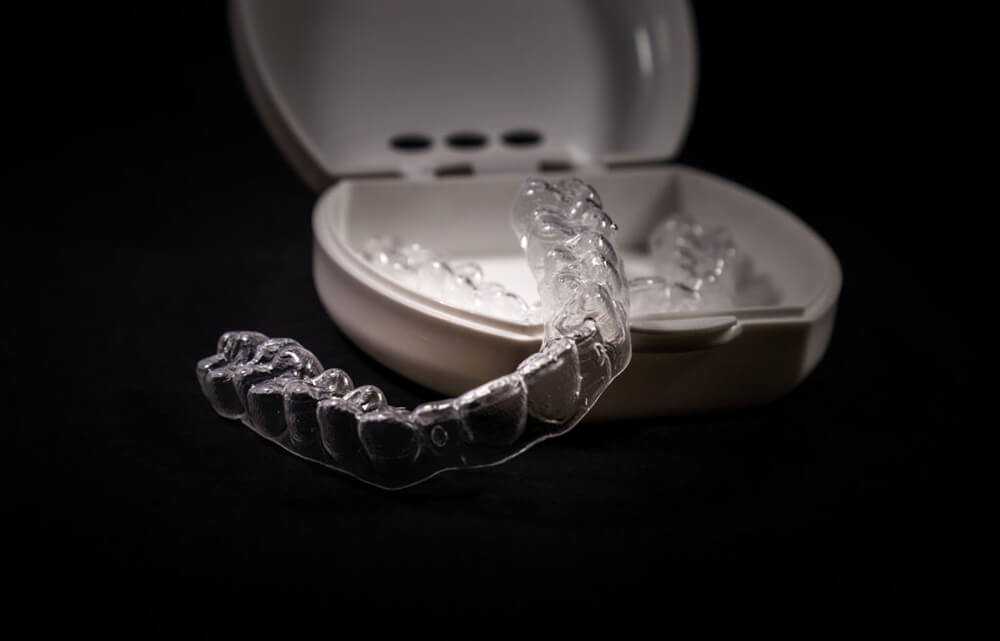 Dr. Steven Harrison - 3D printed braces.