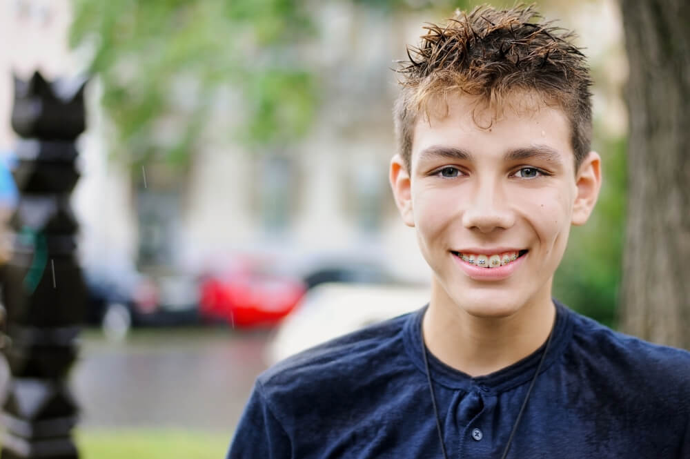 young guy smiles with braces from Dr. Steven Harrison