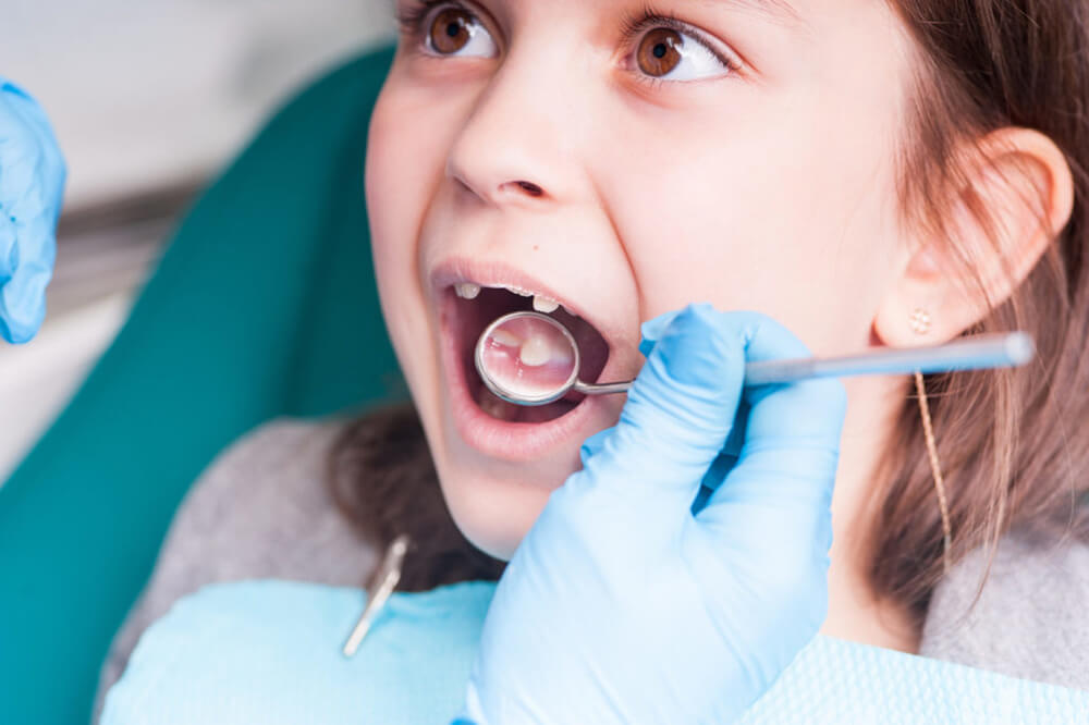 A-child’s-teeth-are-examined-by-a-dentist.-