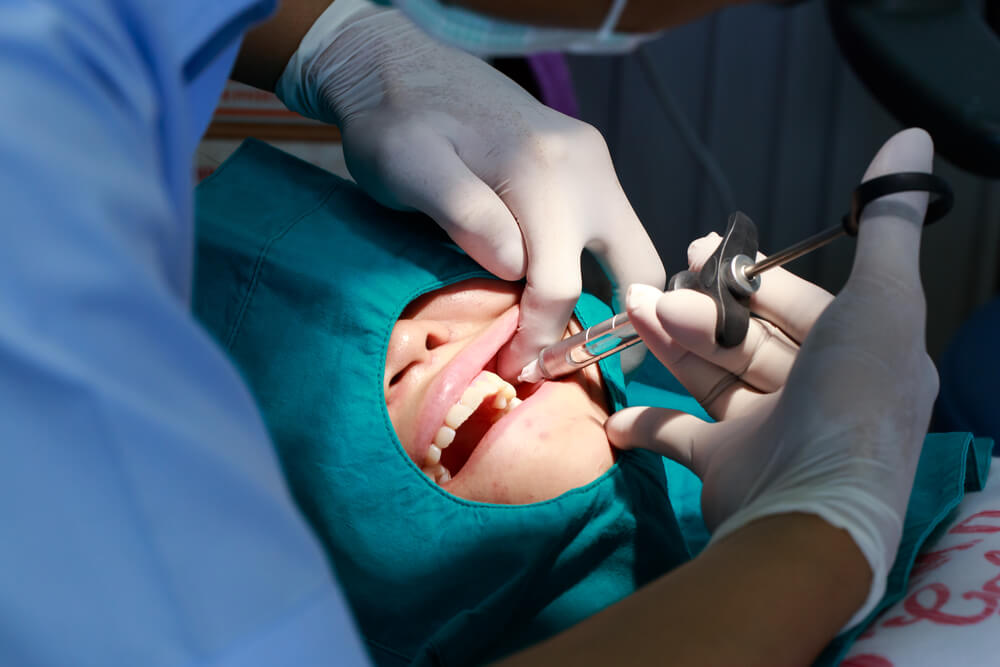 oral surgeon performing procedure