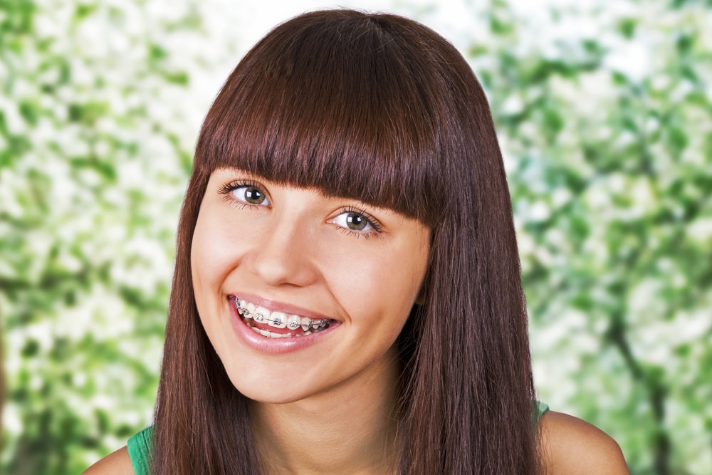 Woman with braces smiling at camera