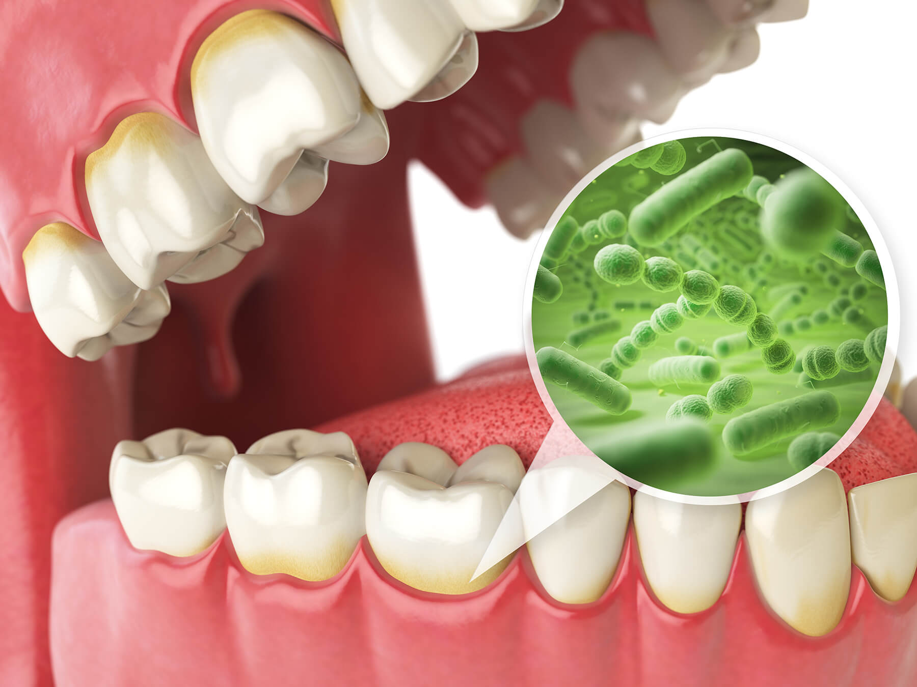 oral-health-and-mouth-bacteria-parkcrest-dental-group