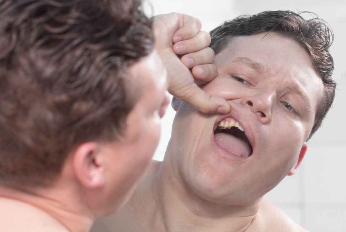 Man looking at teeth in the mirror