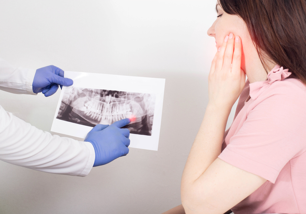 Dentist showing a dental X-ray to a female patient with jaw pain, highlighting an issue with a wisdom tooth