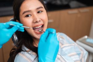 Female patient receiving a dental check-up with dentist using dental mirror and explorer in a modern clinic